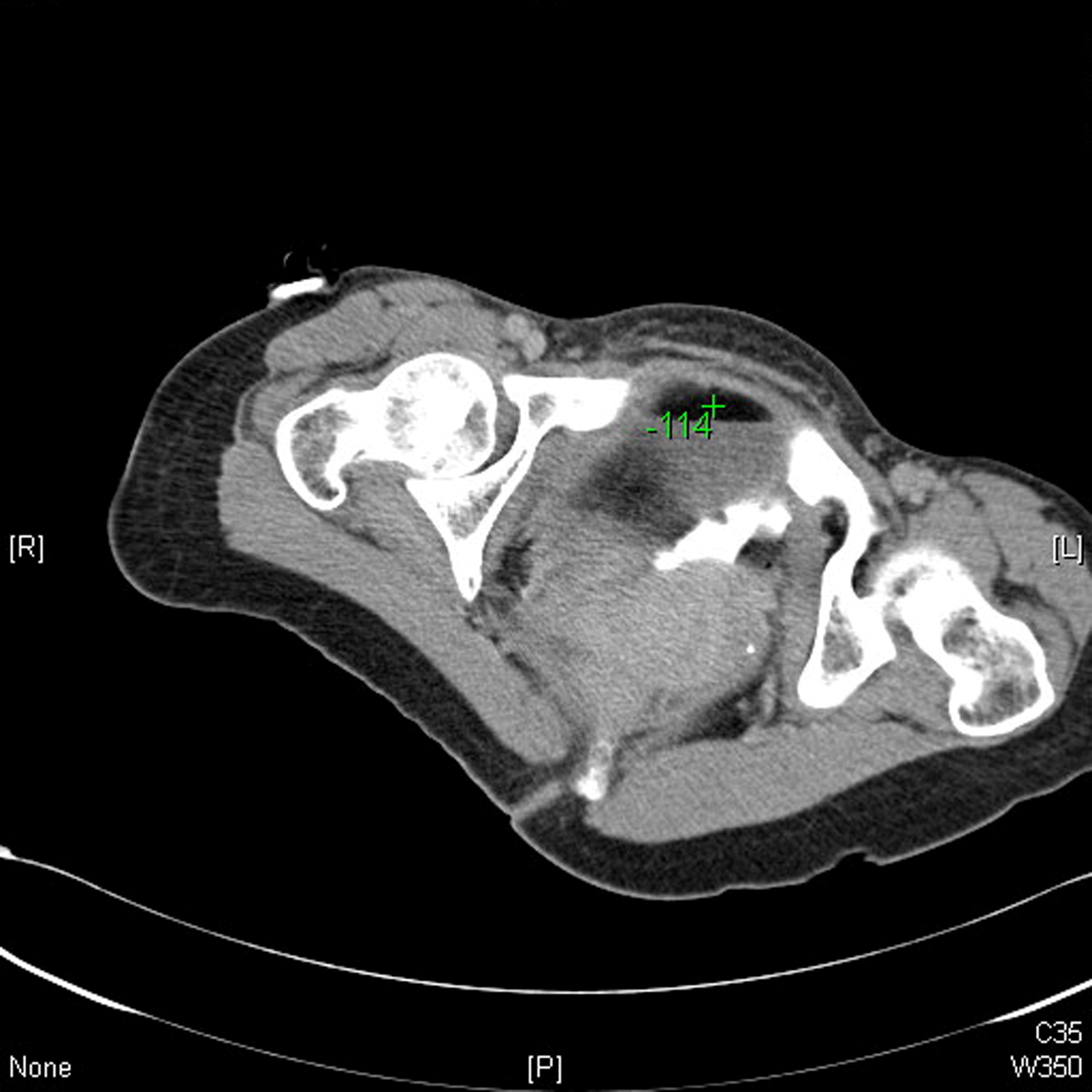 CT - fig 4